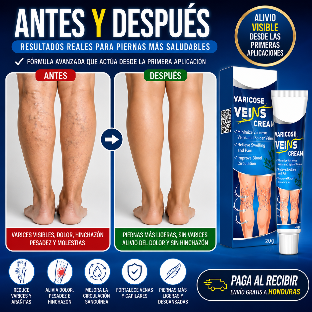 VariCream - Crema reductora de varices, para dolor y piernas hinchadas