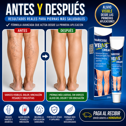 VariCream - Crema reductora de varices, para dolor y piernas hinchadas